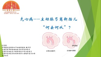 先心病——主动脉弓离断胎儿“何去何从”？