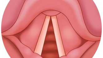 聲音嘶啞，別不當回事